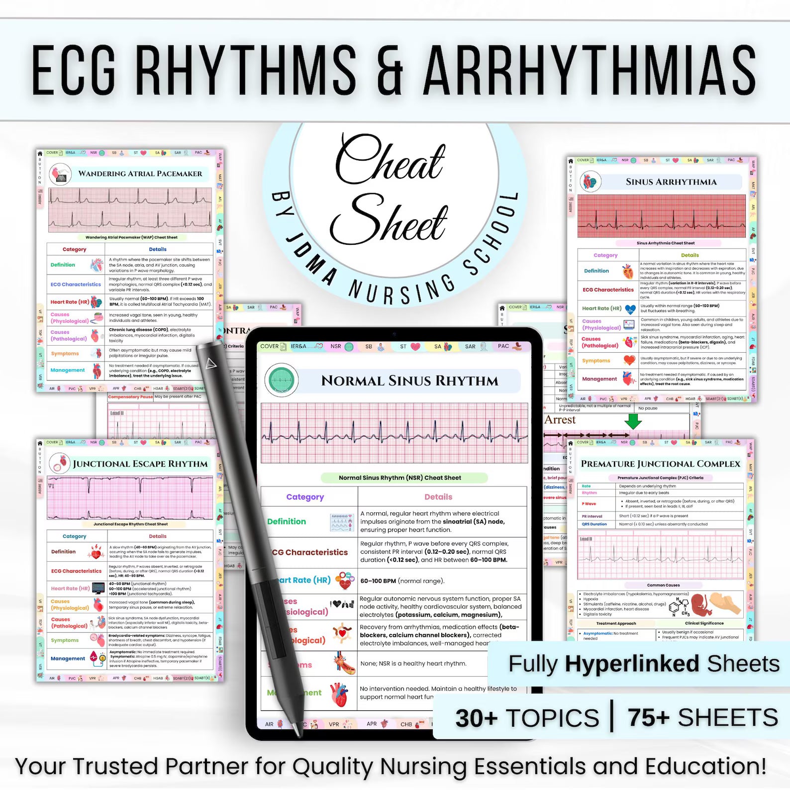 75+ ECG Rhythm & Arrhythmias Cheat Sheet, ECG Study Guide, Nursing Notes, Medical Cheat Sheet, Nursing Student, Free Stickers or Cover pages