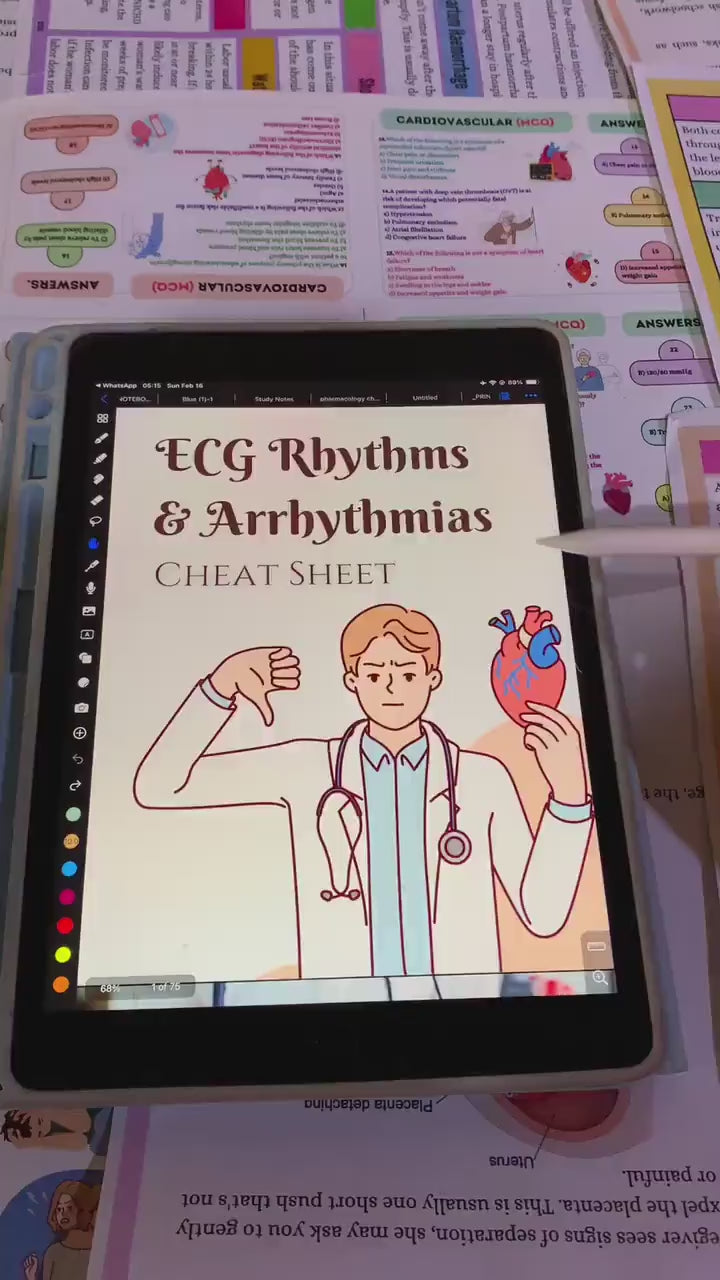 75+ ECG Rhythm & Arrhythmias Cheat Sheet, ECG Study Guide, Nursing Notes, Medical Cheat Sheet, Nursing Student, Free Stickers or Cover pages